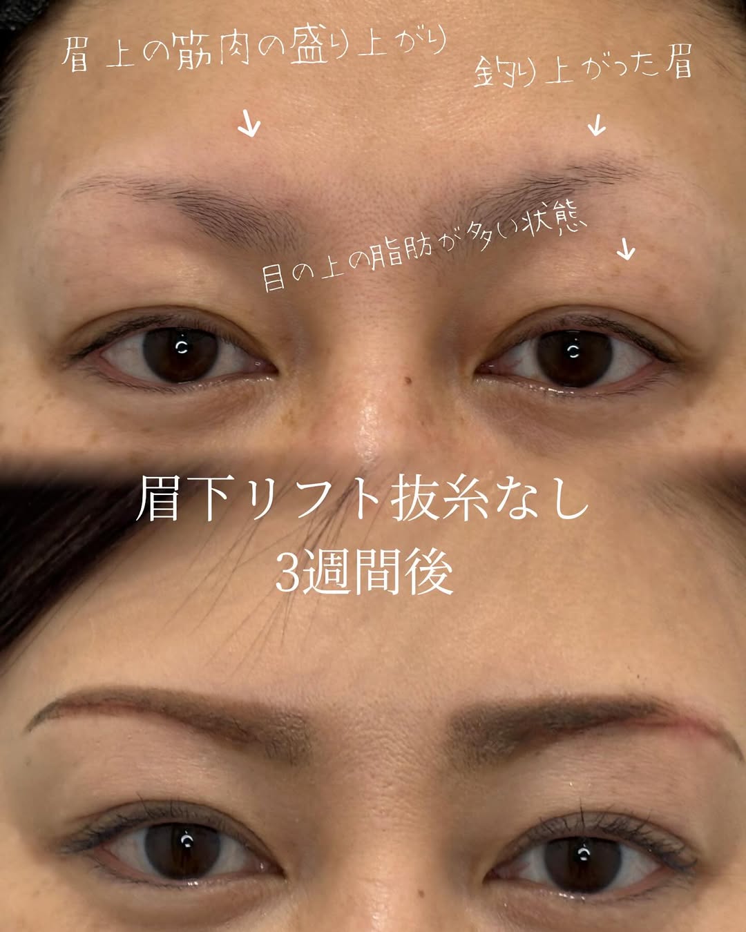 症例
