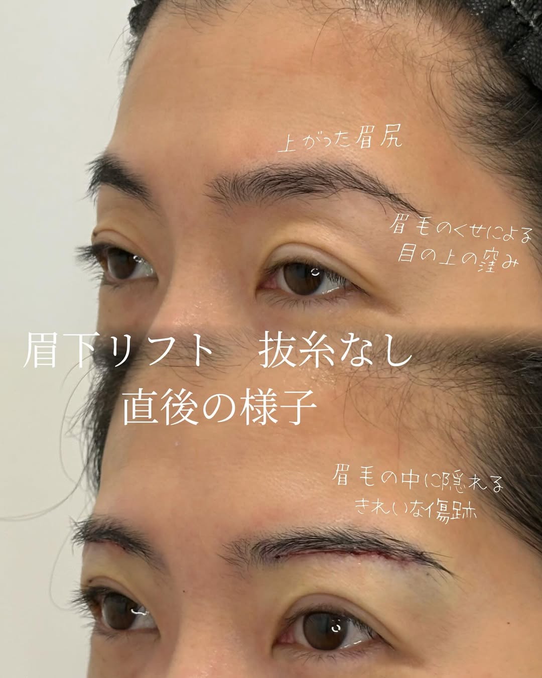症例
