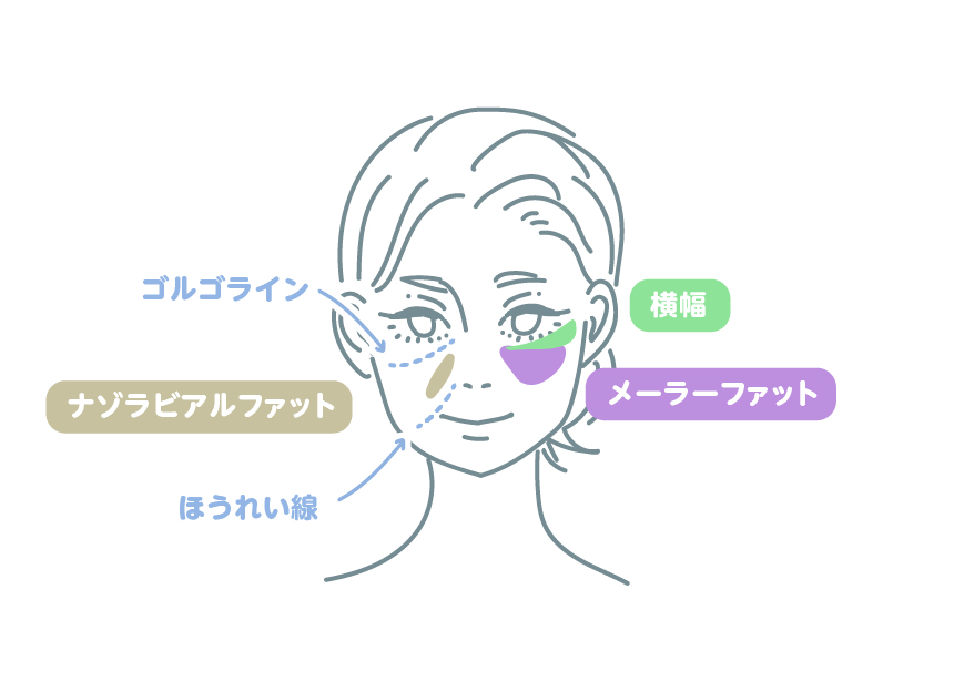 イラスト